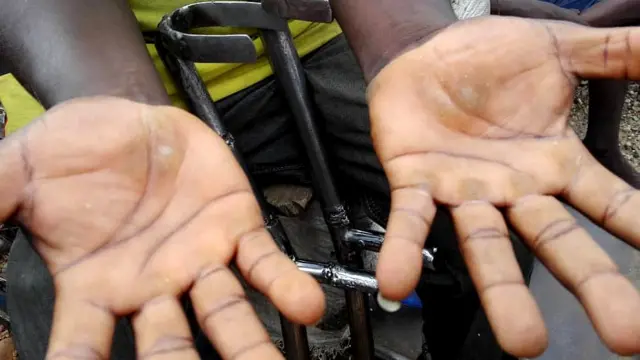 Andre Nibitanga, umwe mu bagendana ubumuga akora urudandazwa