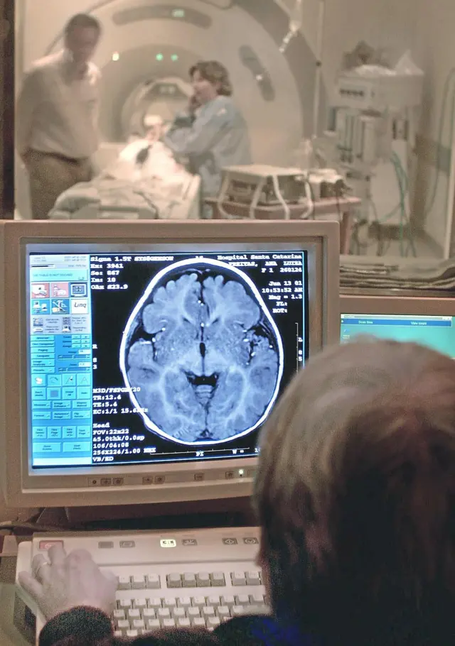 การตรวจสมองด้วยเครื่องสนามแม่เหล็กแรงสูง