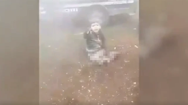 صورة للطفل مبتور الساقين