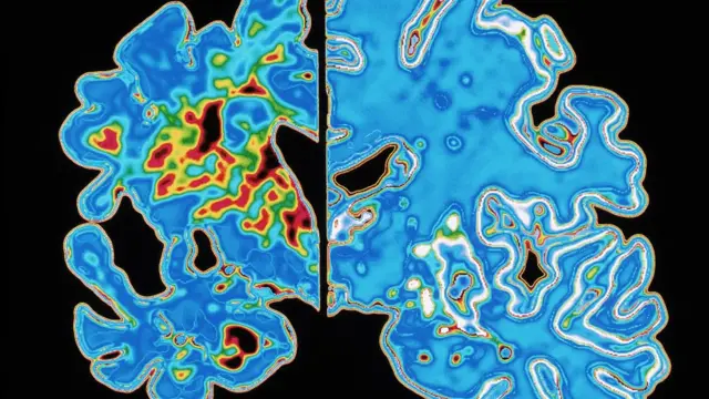 የአዕምሮ ምስል