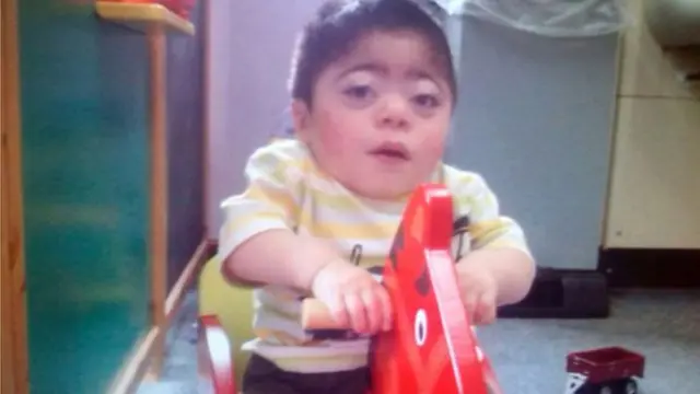 طفلة نتيجة زواج الأقارب في بريطانيا