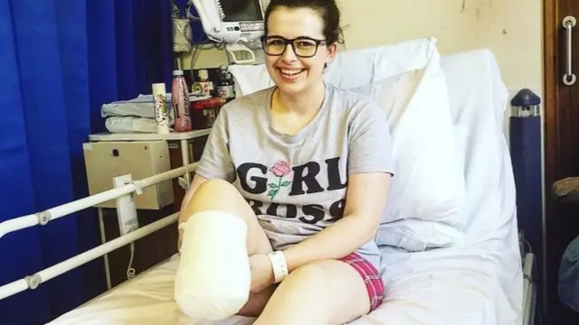 Victoria después de la operación