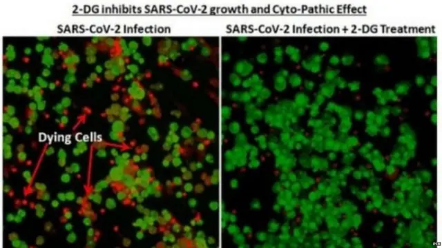 ਐਂਟੀ ਕੋਰੋਨਾ ਡਰੱਗ