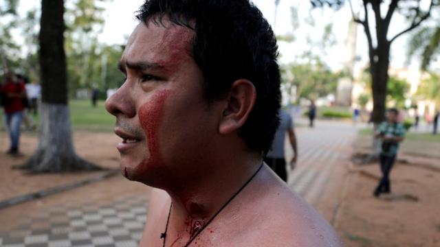 Manifestante herido por una bala de goma.