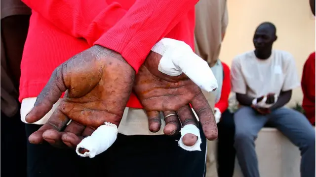 Les assauts sur la barrière de Melilla laissent des séquelles sur les migrants