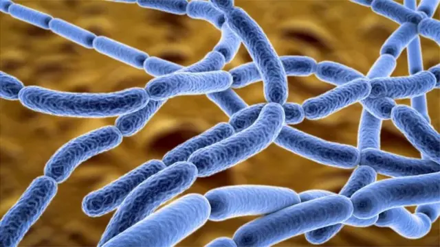 ఆంత్రాక్స్