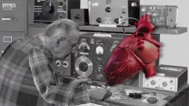 पेसमेकर