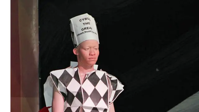 Mid ka mid ah ragga ka soo qeybgalay tartanka quruxda dadka uu maqaarkoodu casyahay ee Albino