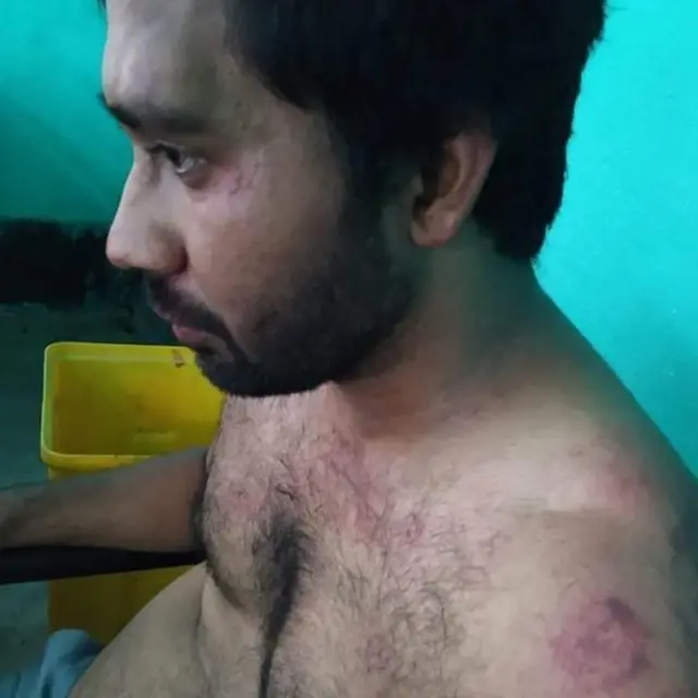 పేషెంట్ బంధువులు జరిపిన దాడిలో డాక్టర్ సేనాపతికి తీవ్ర గాయాలయ్యాయి.