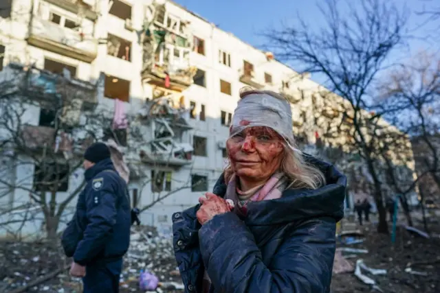 Wounded Ukrainian woman