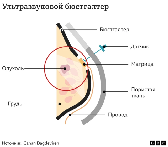 Устройство аппарата