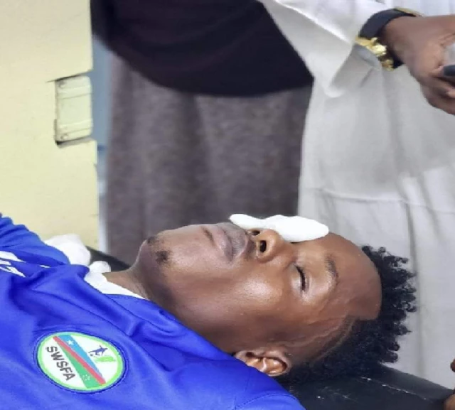 Ciyaaryahan Mxamed oo sida oouu noo sheegay indhaha quraarad ama dhalo ay ka soo gaadhay