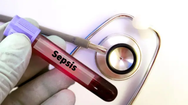 sepsis