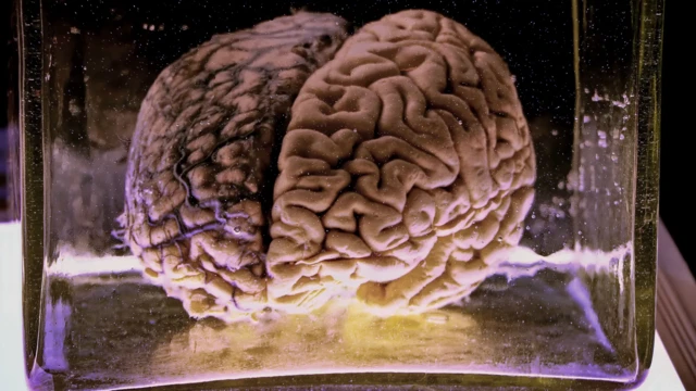 تصویر یک مغز در محفظه شیشهای
