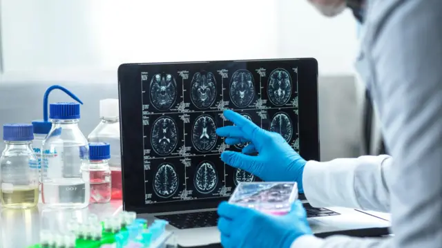Концептуальное изображение, посвященное исследованиям в области нейробиологии. Ученый рассматривает снимок мозга пациента во время клинических испытаний в лаборатории.