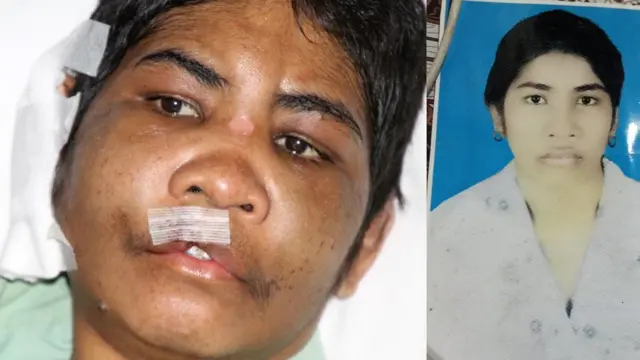 Maariyans Kaabu yeroo hospitaala jirtuufi yeroo fayyaa