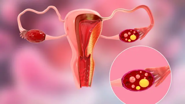 ਔਰਤਾਂ ਦੀ ਜਨਣ ਪ੍ਰਣਾਲੀ