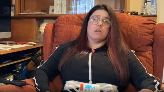 ஸ்கிளீரோசிஸ் குறைபாடு