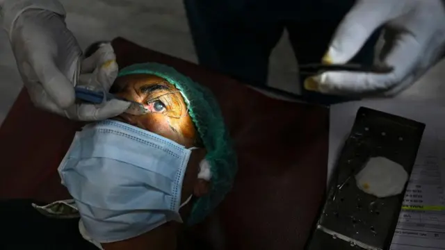 भारत सरकारकडून दरवर्षी हजारो लोकांचे मोतीबिंदूचे ऑपरेशन मोफत केले जात आहे.