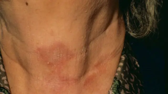 ਐਗਜ਼ੀਮਾ