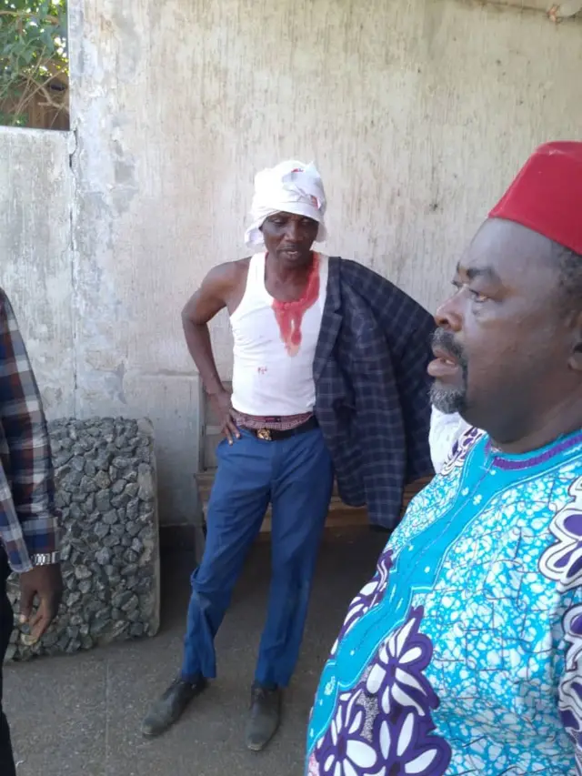 L'ancien député togolais, Targone Sambiri (en débardeur blanc ensanglanté)