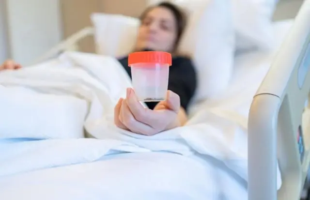 گردے کی پتھری