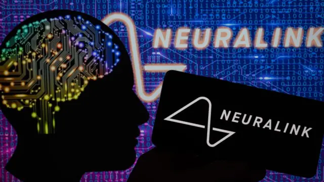 ਨਿਊਰਾਲਿੰਕ