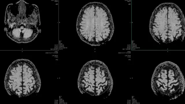 Várias imagens do cérebro humano dispostas lado a lado