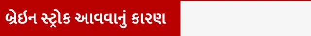 બીબીસી ગુજરાતી, ગુજરાત, હેલ્થ, સ્વાસ્થ્ય,બ્રેન સ્ટ્રોક, અમદાવાદ, ભારત