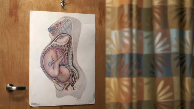 ਗਰਭ ਵਿਵਸਥਾ 