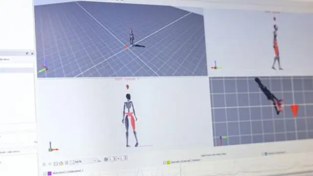 Mwendo unarekodiwa na kuchambuliwa na mfumo wa akili bandia ambao unaweza kutathmini kuzorota yoyote kwa mgonjwa mara mbili haraka kama madaktari bora.