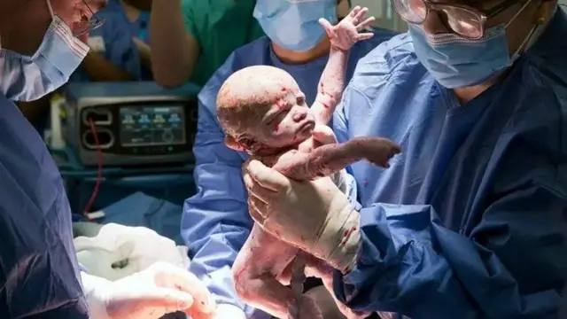 ولادت کے وقت ایمی