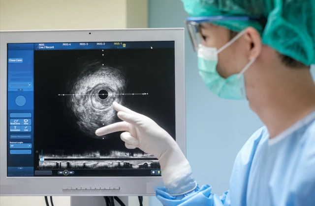 طبيب يرتدي زياً معقماً ويستخدم جهاز التصوير بالموجات فوق الصوتية داخل الأوعية الدموية (IVUS) في غرفة مختبر قسطرة القلب.