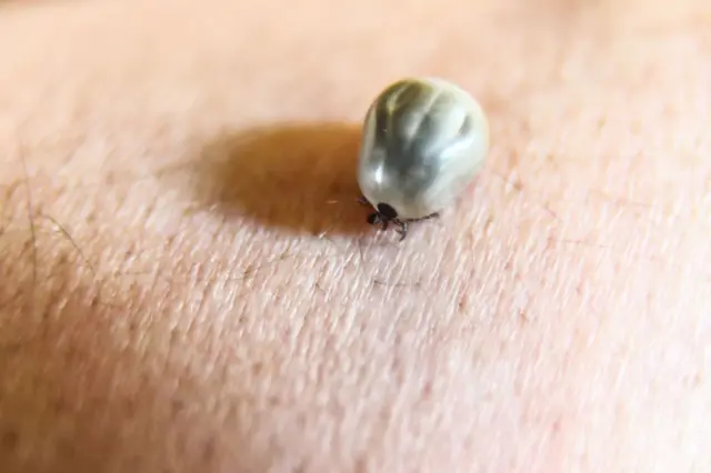 मानवी त्वचेवर गोचिडची एक प्रजाती. 