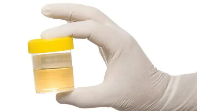 ప్రెగ్నెన్సీ టెస్ట్