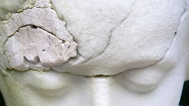 मायग्रेन