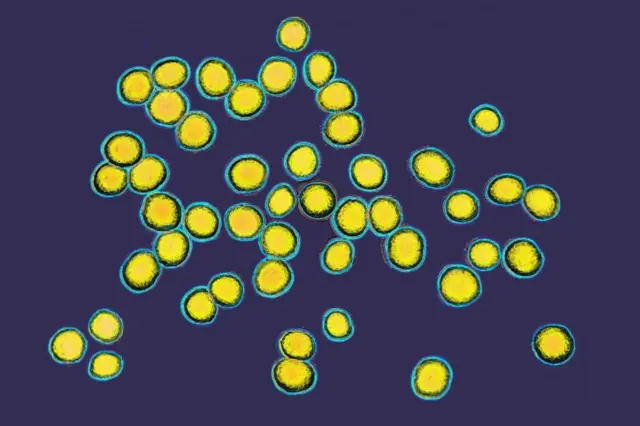 Staphylococcus aureus no microscópio