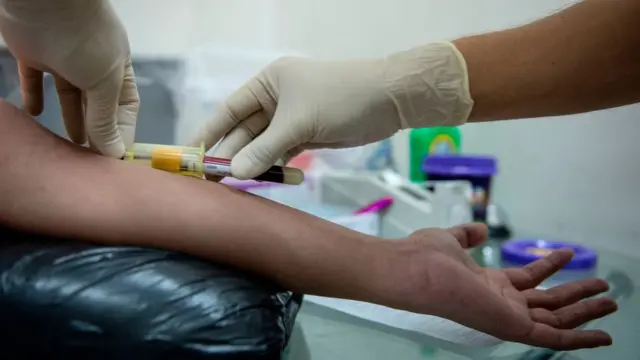 آزمایش اچ‌آی‌وی