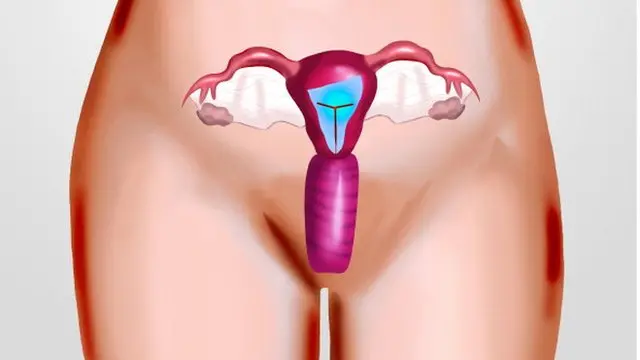 Menopause - Sri Lanka