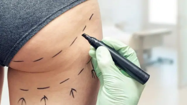 Pesin dey mark pesin buttocks