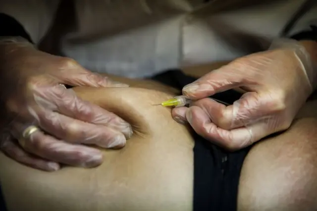 Traitement de la cellulite et des vergetures par carboxythérapie
Traitement de la cellulite et des vergetures par carboxythérapie (Photo : BSIP/Universal Images Group via Getty Images)