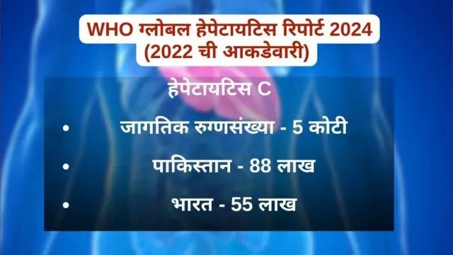 हेपेटायटिस