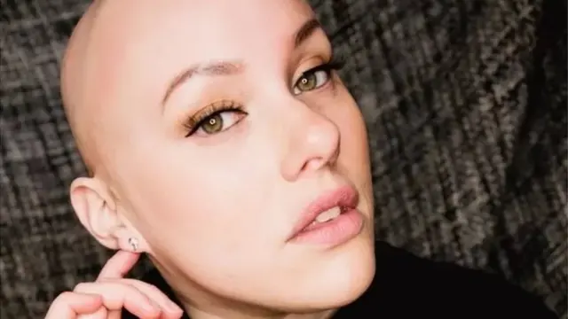 Un trouble déficitaire de l'attention a été diagnostiqué chez Laura Mathias.