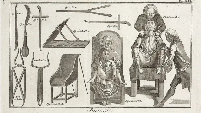 Gravura do século 18aposta bet365 hojecirurgiões, pacientes e instrumentos