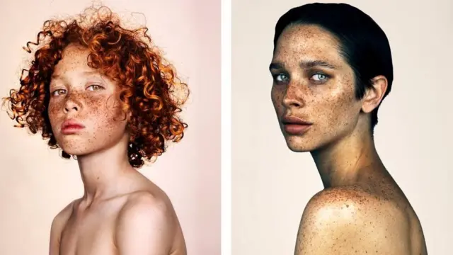 கரும்புள்ளிகள்