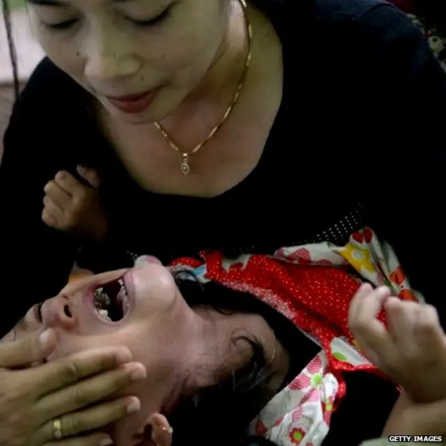 సున్తీ, ఖత్నా, మహిళలు