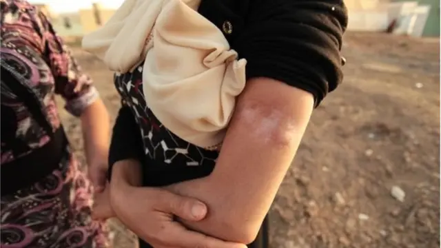 সিরিয়া, আইএস