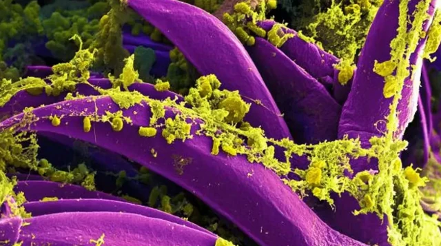 ภาพขยายเชื้อกาฬโรค Yersinia pestis (สีเหลือง) บนตัวเห็บหมัด (สีม่วง)