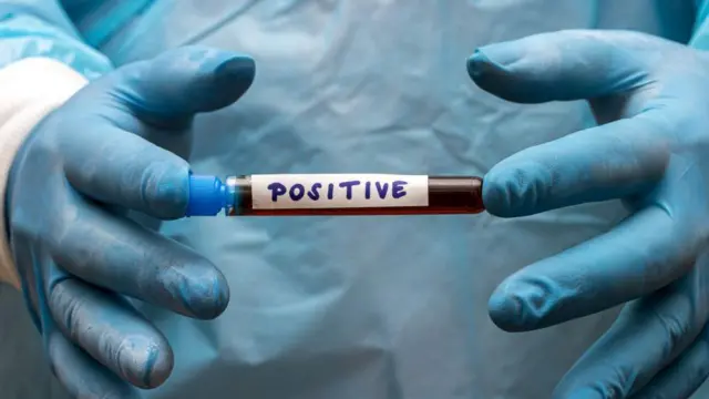 కర్నూలు, నర్సు, డాక్టర్, ప్రేమ, హెచ్ఐవీ