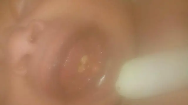 Daa'ima ilkaan waliin dhalate